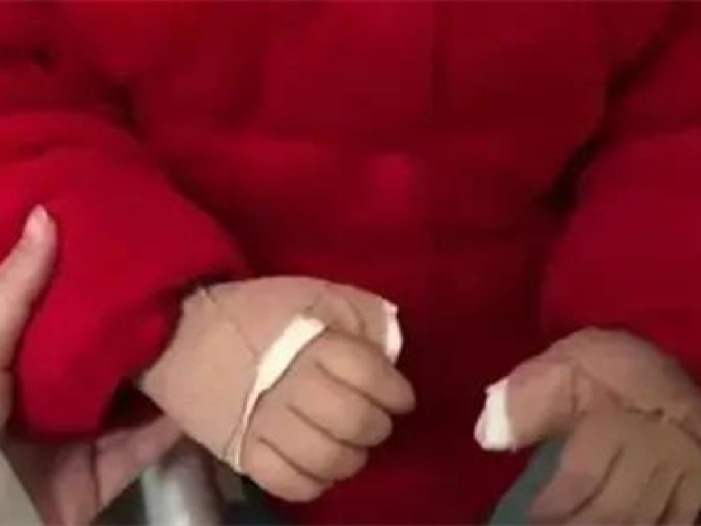 家長們，別再把手機當“哄娃利器”，3歲娃因此手指僵硬伸不直